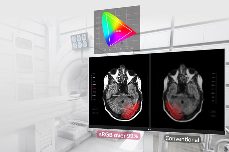 The image shows an MRI room, with medical equipment visible in the background. In the forefront, two medical scans of a brain are displayed on a widescreen monitor. The scans are black and white with distinct red highlights in certain areas. One is labeled sRGB over 99% and is more vividly colored and higher contrast. The other side, labeled conventional, is lower contrast and less crisp in comparison. Above the monitor, there is a colorful triangular diagram labeled "sRGB," indicating a color space. It is set against a graph with a gray grid background.