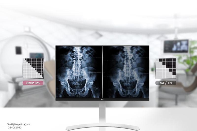 The image displays a medical setting with a focus on a computer monitor showing two identical X-ray images of a human spine and pelvis. The monitor is centrally positioned in the foreground, mounted on a sleek, modern stand. To the left of the monitor is an inset graphic labeled "8MP IPS," and to the right, another graphic labeled "VA / TN," both showing different representations of pixel clarity or contrast.