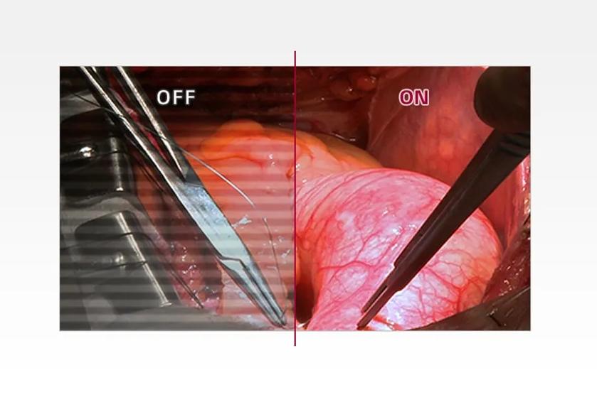 The image is divided into two sections by a vertical red line. The left side, labeled "OFF," shows a less illuminated view of internal tissues, with shadows and muted colors representing flickering screen. Visible are various surgical instruments, including forceps, in a dim environment. The right side, labeled "ON," shows the same area with reduced flicker, displaying vibrant and detailed images for reduced visual fatigue.