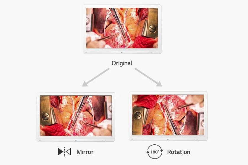 Image with three monitors displaying variations of a surgical scene: original, mirrored, and rotated 180 degrees.