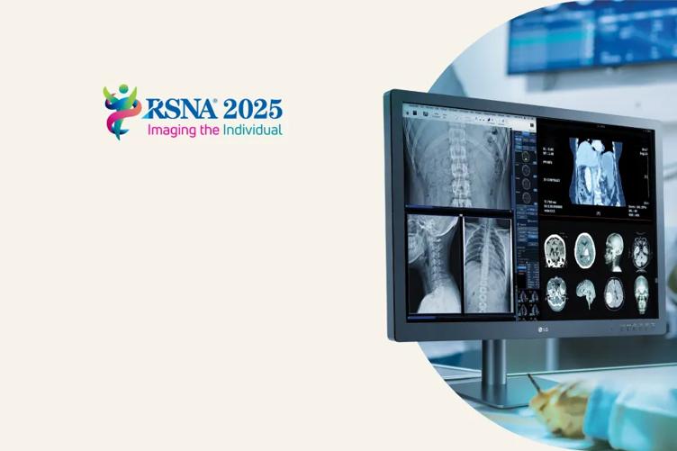 LG Medical Monitor on a warm beige background, with the RSNA 2025 logo in the top left.
