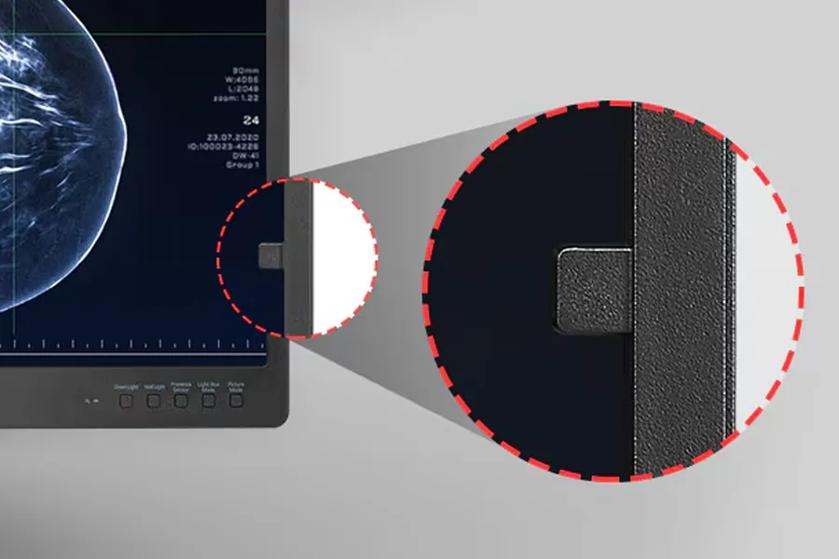 LG diagnostic monitor showing a medical image and a magnified view of the calibration sensor on the screen edge.