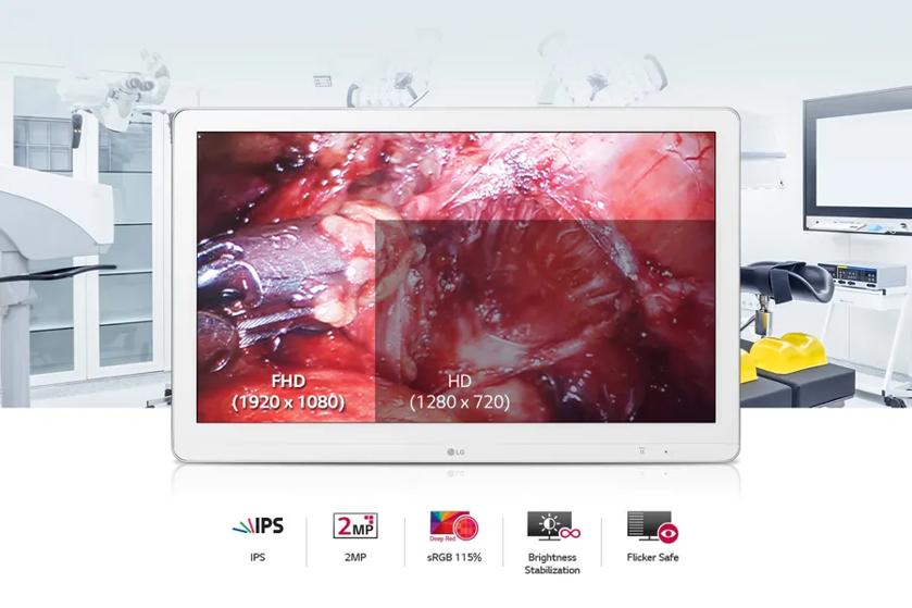 The image shows an LG surgical display screen in a clinical setting. The screen displays a high-resolution surgical image with vivid red tones, showing a detailed view of internal tissues, likely during a medical procedure. Two sections on the screen are labeled with different resolution options: "FHD (1920 x 1080)" and "HD (1280 x 720)." The display emphasizes the capability to view content in full high definition. Surrounding the monitor are parts of what appear to be medical equipment and bright operating lights, hinting at an operating room environment. Beneath the monitor, there are icons representing features of the display including IPS, 2MP, sRGB 115%, Brightness Stabilization, and Flicker Safe.