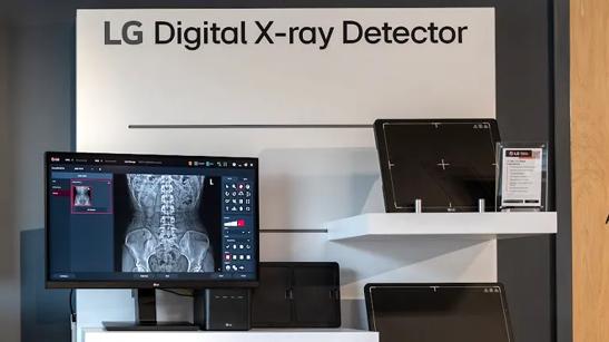 An LG Digital X-Ray Detector on display next to a medical monitor showing an x-ray readout.