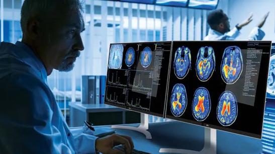 A doctor uses LG monitors to examine MRI scans.