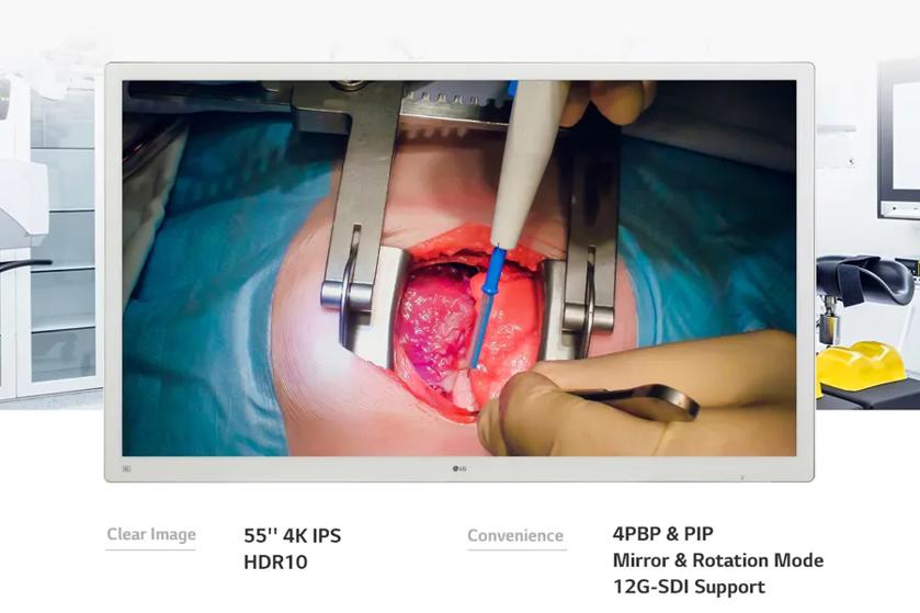 LG surgical monitor displaying a high-resolution image of a surgical procedure.