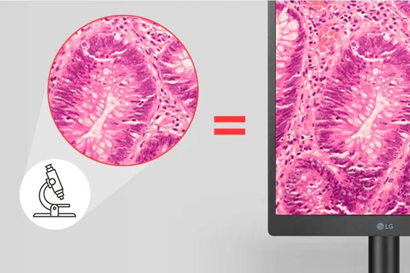 Pathology Mode view of a medical scan displayed on a computer monitor.