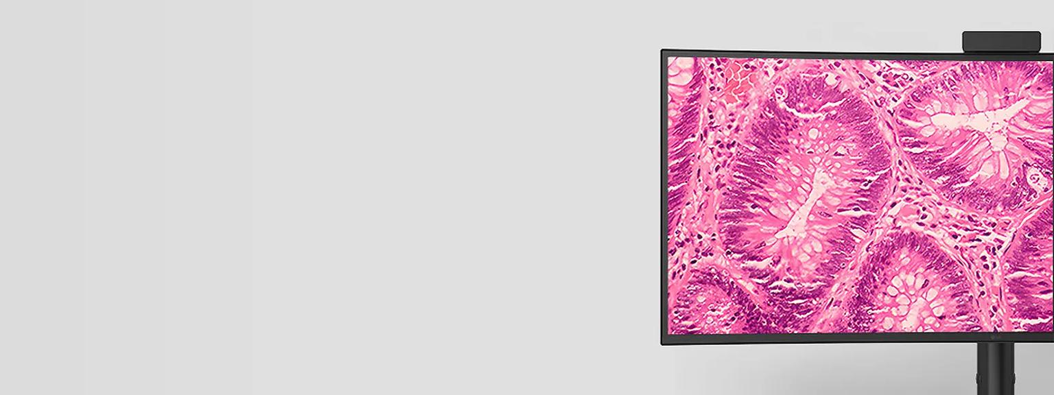 LG Medical Monitor