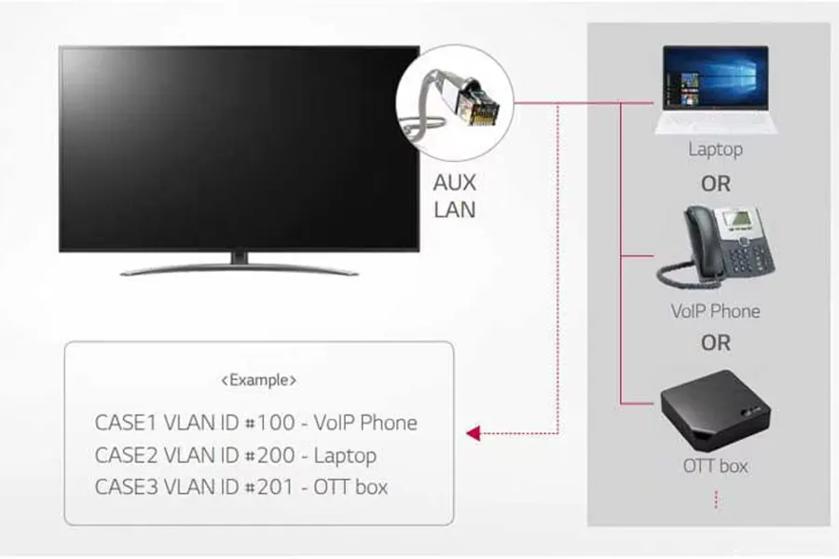 Diagram showing AUX LAN connections to a monitor, laptop, VoIP phone, and OTT box.