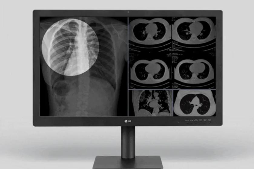 The image displays an LG diagnostic monitor showing medical imaging scans. A brighter circle highlights part of the scan, showcasing the focus view mode.