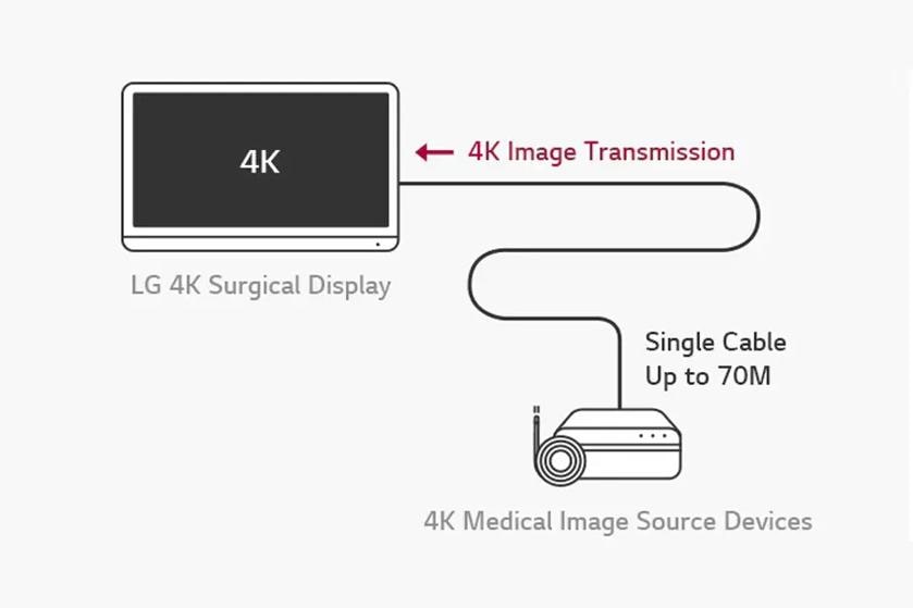 Diagram of 4K image transmission from a medical source device to an LG 4K surgical display.