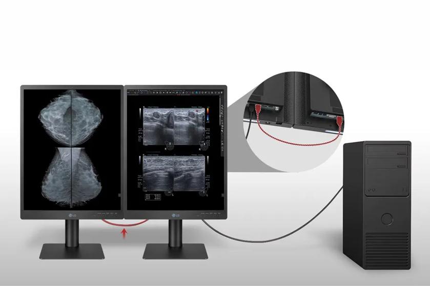 The image showcases two LG diagnostic monitors positioned side by side. The left monitor displays a grayscale medical image resembling a mammogram with mirrored upper and lower views. The right monitor shows four separate grayscale ultrasound images, each with detailed medical data and annotations displayed on a black background. Below both screens are control buttons and the LG logo. The monitors are mounted on flat, rectangular stands. A computer tower is positioned to the right, connected to the monitors by cables. An inset circle highlights the rear connection of the monitors, showing red cables plugged into the back.