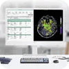 Thin Client for Healthcare