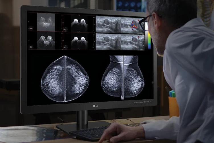 A doctor in a darkened office. He's leaning towards an LG Clinical Monitor, looking at the mammogram images and other medical information displayed on it. 