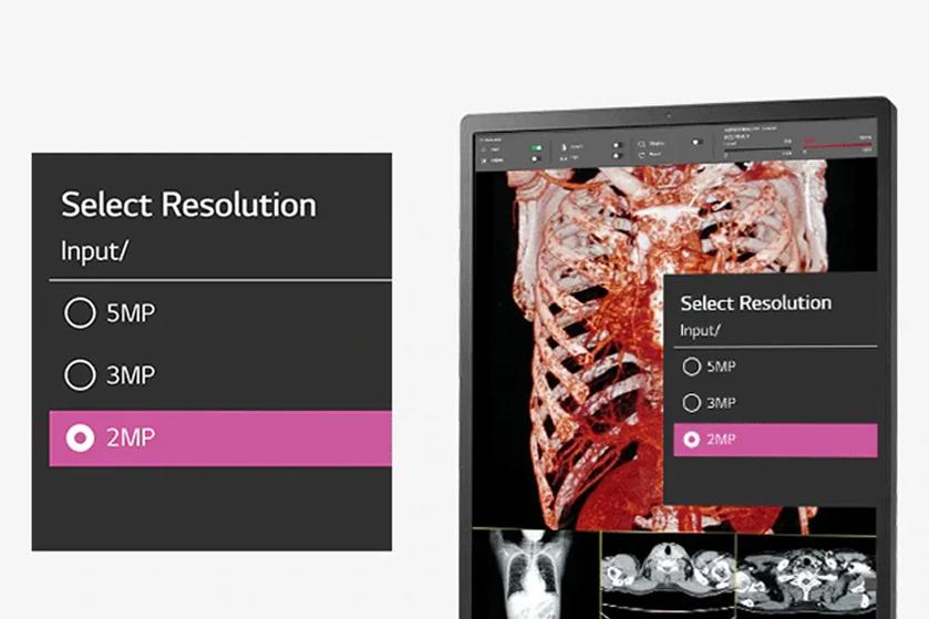 LG diagnostic monitor showing medical images with a resolution selection pop-up.