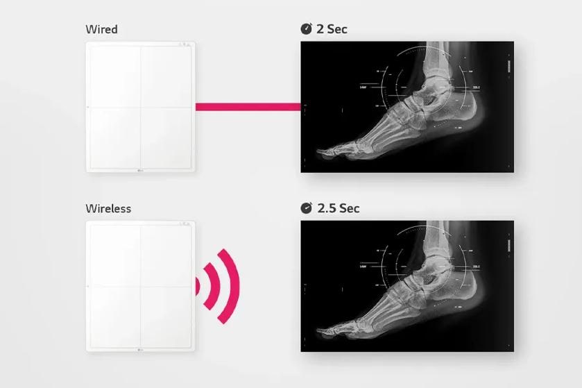 The image showcases a comparison between wired and wireless LG digital x-ray detectors. On the left, two detectors are shown vertically. The top detector is labeled "Wired" and is connected by a pink line to an x-ray image on the right. The bottom detector is labeled "Wireless" with red wireless signal lines emanating from it, also pointing to another x-ray image on the right. Both x-ray images depict the side view of a foot, highlighting bones and joints. The upper x-ray shows a time of "2 Sec" while the lower one shows "2.5 Sec," indicating the time taken for image capture.