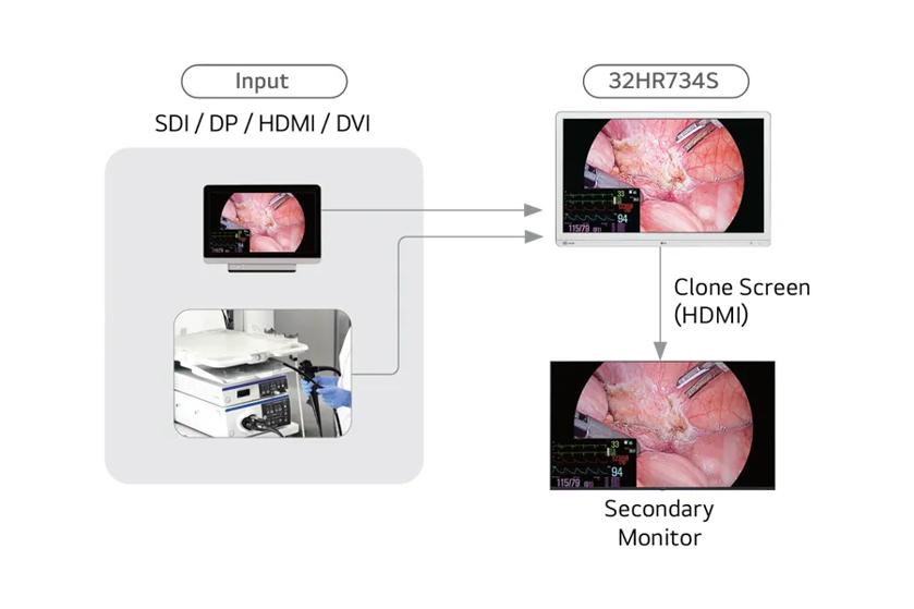Diagram of a medical imaging setup with input and secondary display monitors.

Transcribed Text:

Input
SDI / DP / HDMI / DVI
32HR734S
Clone Screen (HDMI)
Secondary Monitor