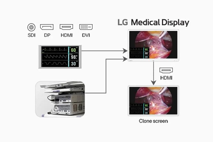 Diagram of an LG Medical Display setup with multiple screens and connectivity options.