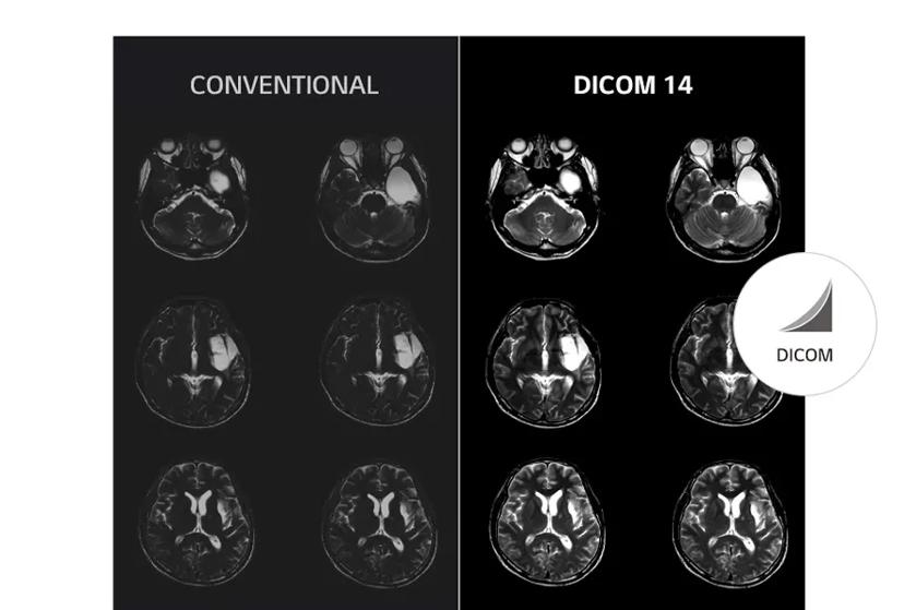 Comparison of brain MRI scans in conventional and DICOM 14 formats.