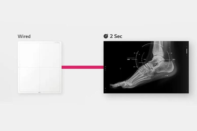 Digital X-ray detector connected to a foot X-ray image with a "2 Sec" label.