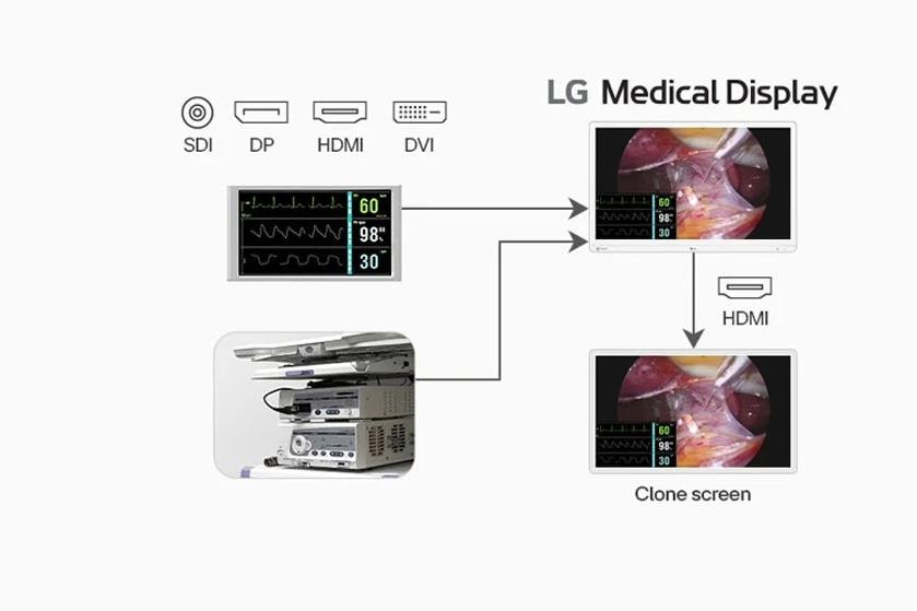 32HR732S-W Surgical Monitor Clone Screen