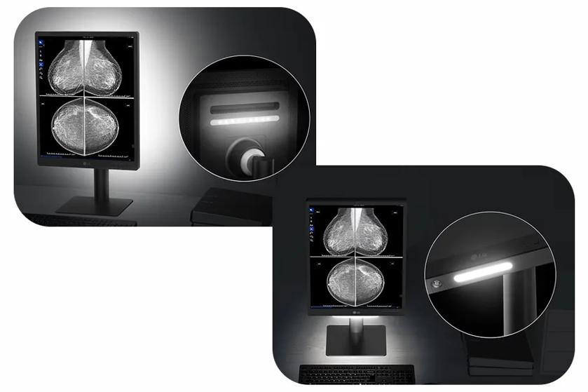 The image shows a diagnostic monitor setup from LG, positioned on a desk with a keyboard. The monitor displays grayscale medical imagery. The display is surrounded by a dark frame and supported by a robust stand. Two circular insets magnify specific features: the left inset highlights a panel on the back of the monitor with a row of ventilation slats and a cable connection port; the right inset focuses on the front of the monitor where an illuminated LED strip is visible near the top edge, emphasizing the monitor's lighting feature.
