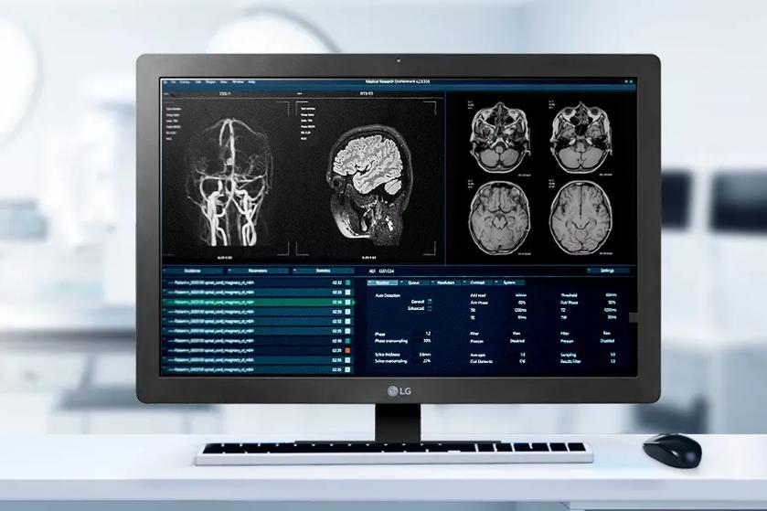 LG diagnostic monitor showing medical brain scans and various scan settings.