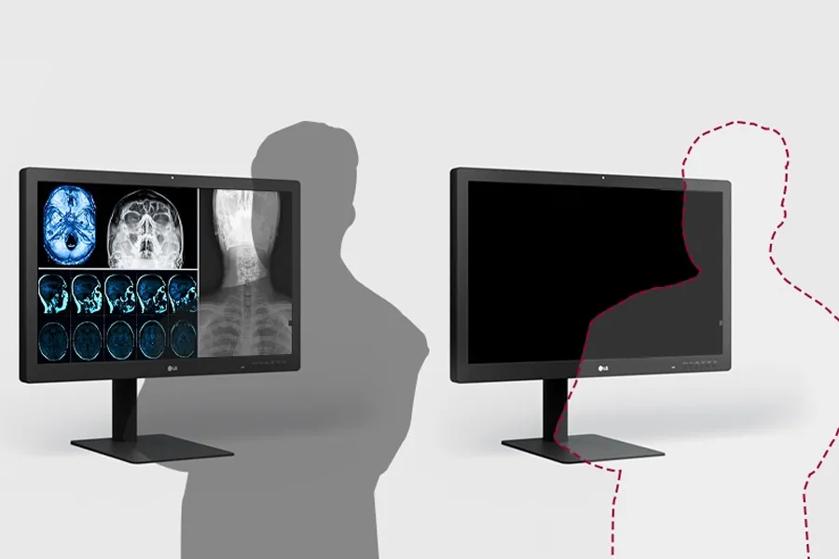 The image displays two LG diagnostic monitors on a plain light gray background. The monitor on the left shows medical images, including CT or MRI scans of the brain and X-ray images of the neck and spine. These images are in shades of blue and gray. The monitor on the right is turned off, displaying a black screen. Both monitors are mounted on slim stands with wide, flat bases. Additionally, a shadow silhouette of a person is visible behind the left monitor, and a dotted pink outline of another person is positioned in front of the right monitor.