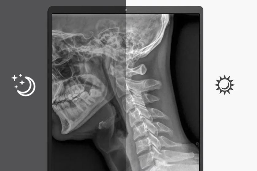 LG Diagnostic monitor with X-ray of a skull and neck, with night and day display modes.