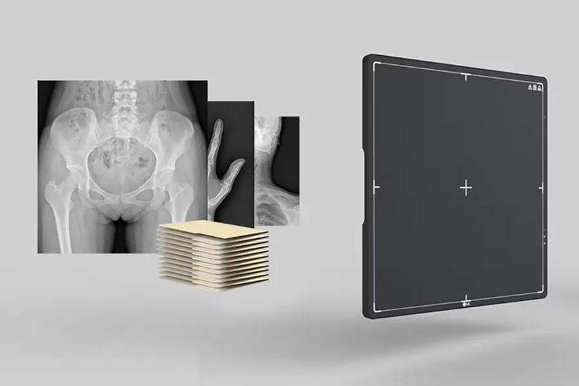 LG digital x-ray detector with overlapping x-ray images of a pelvis and a hand.