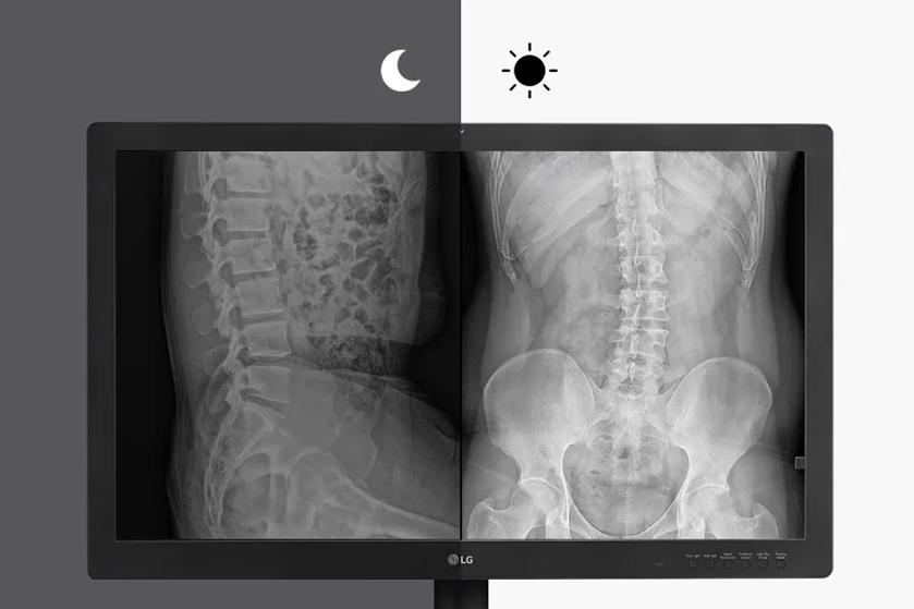 LG Diagnostic monitor with X-rays, with night and day display modes.