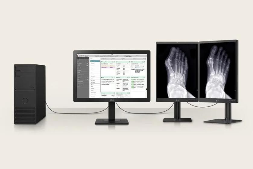The image displays a computer setup featuring three LG diagnostic monitors and a black desktop tower on a beige background. The central monitor shows a medical interface with patient information, including sections for name, age, and medical readings. The two monitors on the right display identical X-ray images of a human foot. All monitors are connected via cables to the desktop tower. The monitors have thin black bezels and stand on rectangular bases.