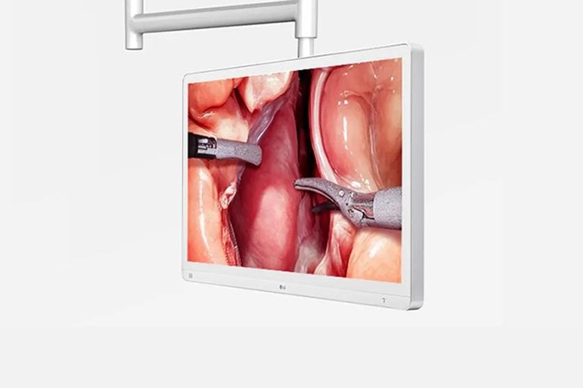 The image shows a 9.2kg lightweight medical display mounted on a ceiling, displaying a surgical procedure.