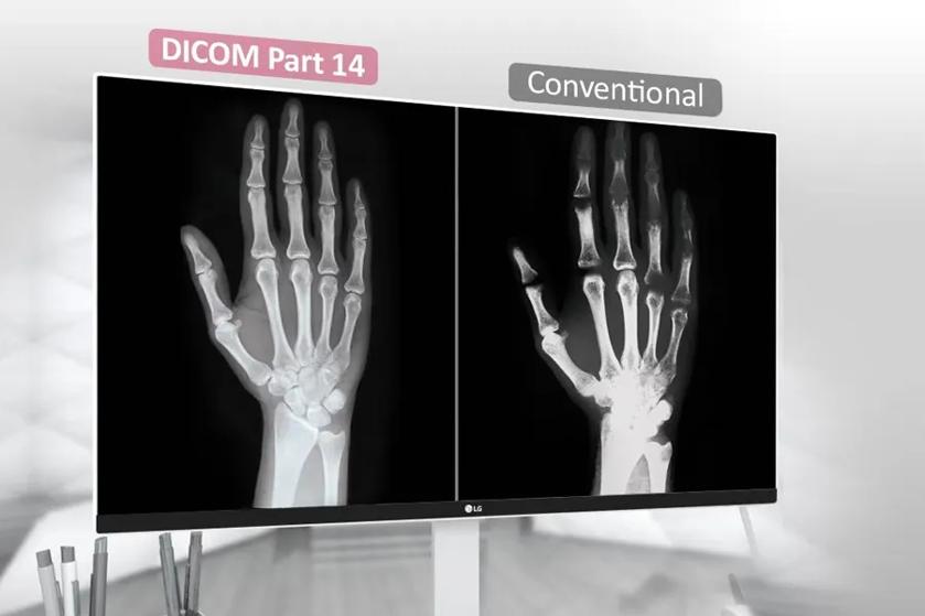The image displays a computer monitor showing two side-by-side X-ray images of a hand. The left side is labeled "DICOM Part 14" and shows a clear, detailed X-ray of a left hand with visible bones and joints, characterized by sharp contrast and clarity. The right side is labeled "Conventional" and shows a more traditional, less detailed X-ray of a right hand with slightly blurred bone structures and lower contrast. 