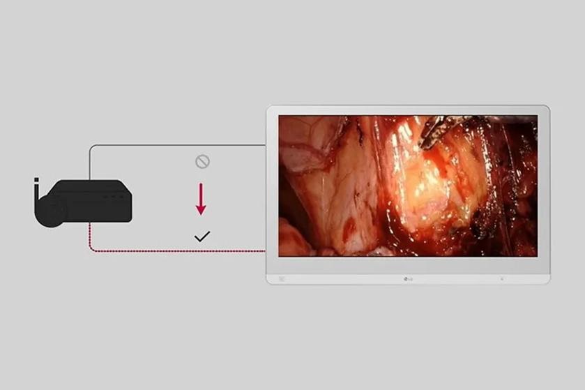 Diagram of a wireless connection setup to an LG medical monitor with a surgical image displayed.