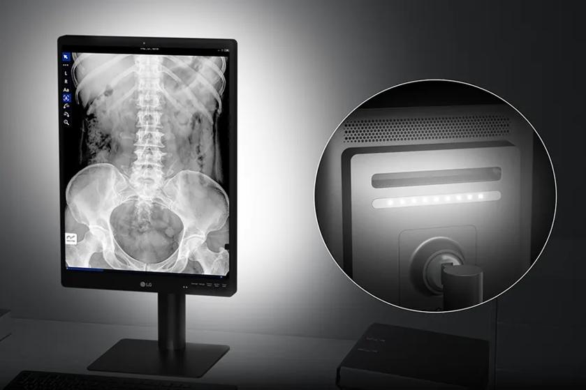 The image shows a diagnostic monitor setup from LG, positioned on a desk with a keyboard. The monitor displays grayscale medical imagery. The display is surrounded by a dark frame and supported by a robust stand. A circular inset focuses on the front of the monitor where an illuminated LED strip is visible near the top edge, emphasizing the monitor's lighting feature.