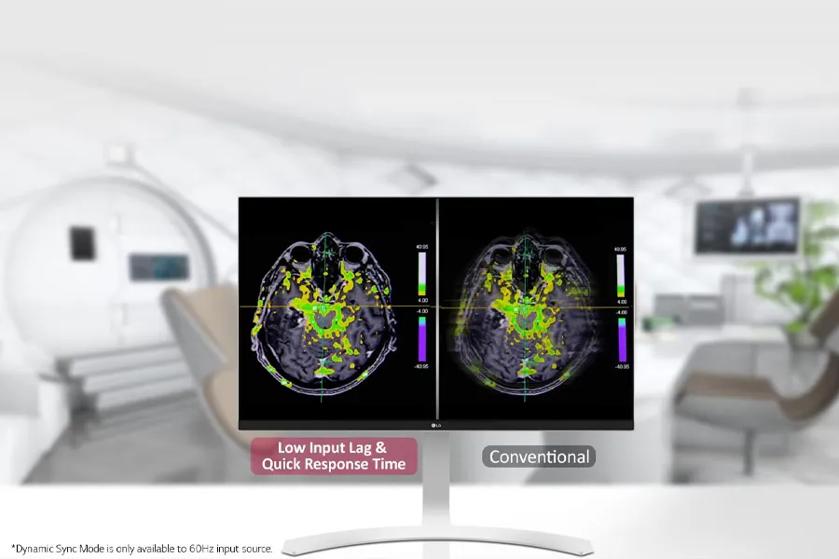 The image shows a modern, clean medical imaging room with a focus on a dual-screen display of MRI brain scans. The background is softly blurred, featuring an MRI machine to the left and seating with monitors to the right, indicating a clinical setting. In the foreground, a monitor stand supports two side-by-side screens displaying MRI images of a brain. The left screen is labeled "Low Input Lag & Quick Response Time," showcasing a sharper image with vivid greens and yellows. The right screen is labeled "Conventional" and shows a similar image with slightly less clarity and brightness.