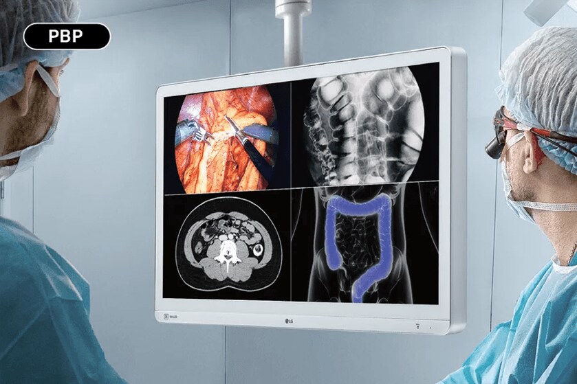 Medical professionals examining a wall-mounted monitor displaying multiple medical images in a clinical setting.

Transcribed Text:

PBP