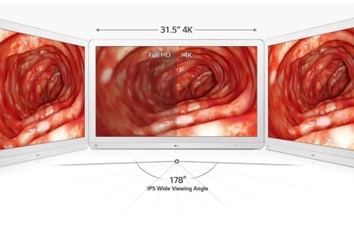 31.5” 8MP Color Diagnostic Monitor | 32HL512D-B | LG Business