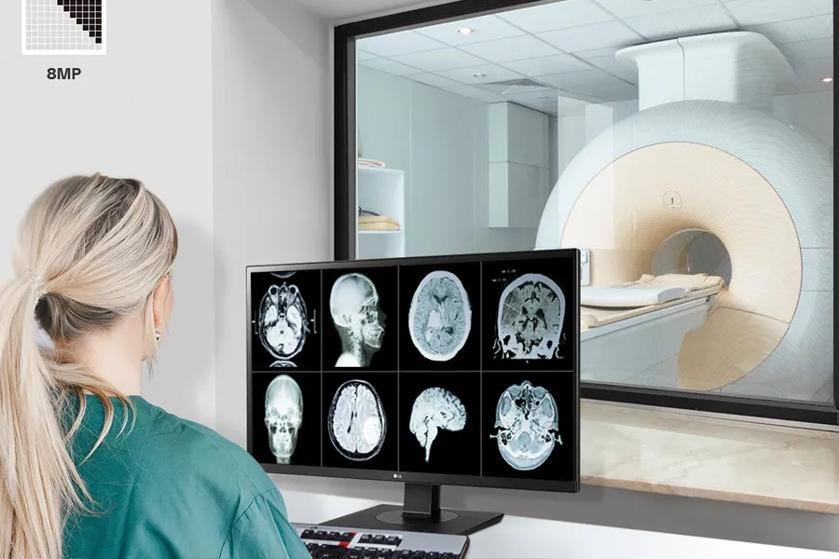 Person in medical scrubs reviewing brain scans on an LG monitor, with an MRI machine visible through a window.