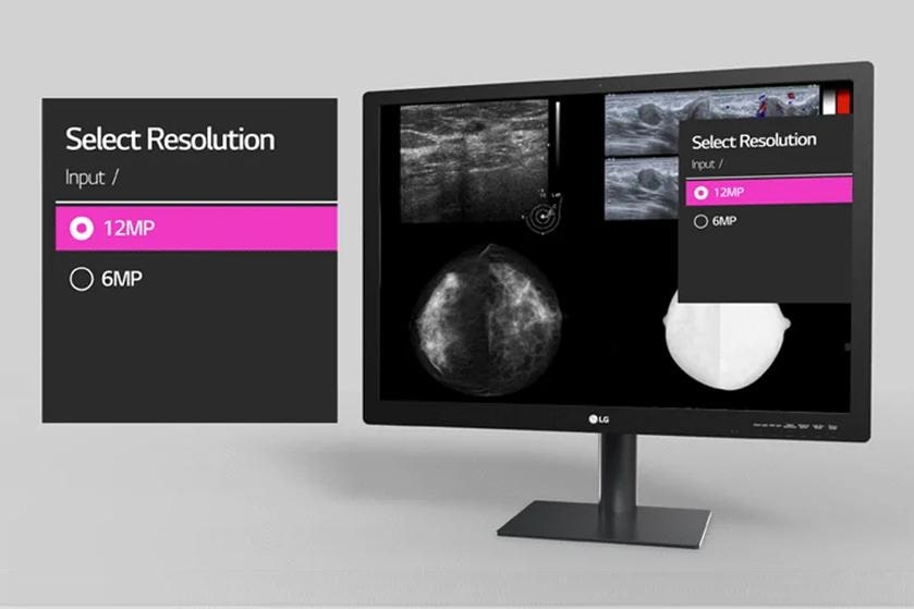 LG diagnostic monitor showing medical images with a resolution selection pop-up.