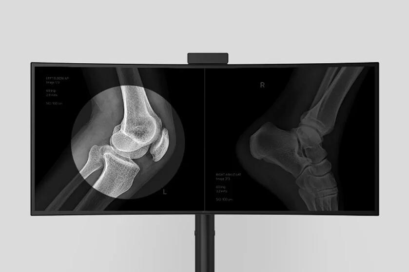 Focus View Mode on the LG 40HT513D highlights selected areas of an X-ray image while dimming the surrounding screen.	
