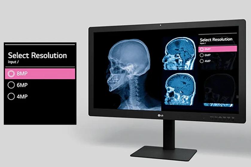 LG diagnostic monitor showing medical images with a resolution selection pop-up.