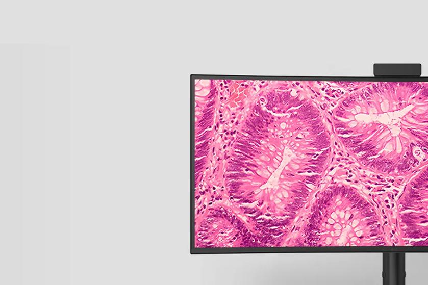 Pathology Mode on the LG 40HT513D enhances color reproduction and image clarity for pathology image review.	