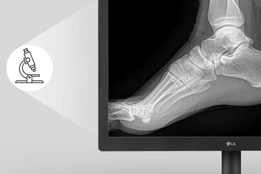 Monitor displaying an X-ray of a human foot alongside a microscope icon.