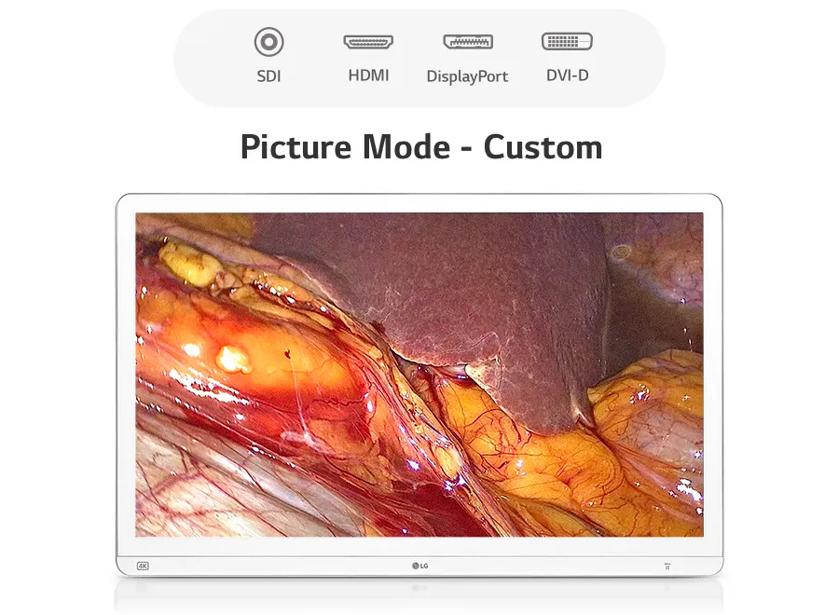 A screen displaying an anatomical image with the text "Picture Mode - Custom" above it.

Transcribed Text:

SDI HDMI DisplayPort DVI-D

Picture Mode - Custom